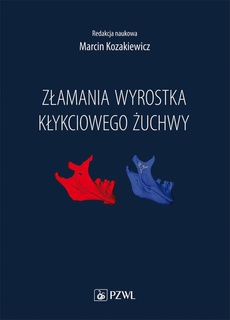 The cover of the book titled: Złamania wyrostka kłykciowego żuchwy