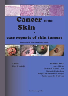 The cover of the book titled: Cancer of the Skin - case reports of skin tumors