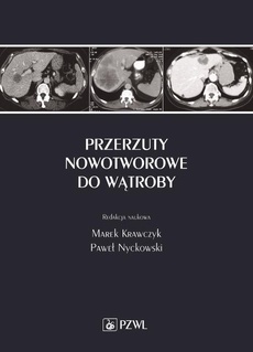 The cover of the book titled: Przerzuty nowotworowe do wątroby