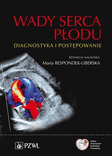 The cover of the book titled: Wady serca płodu