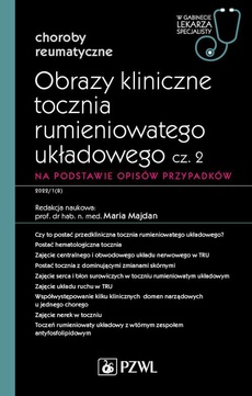 The cover of the book titled: W gabinecie lekarza specjalisty. Reumatologia. Obrazy kliniczne tocznia rumieniowatego układowego, cz. 2