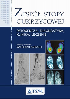The cover of the book titled: Zespół stopy cukrzycowej