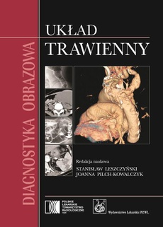The cover of the book titled: Diagnostyka obrazowa. Układ trawienny