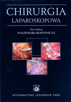 The cover of the book titled: Chirurgia laparoskopowa