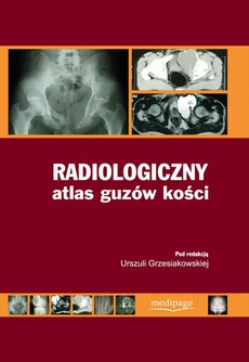 The cover of the book titled: Radiologiczny atlas guzów kości