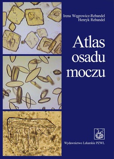 The cover of the book titled: Atlas osadu moczu