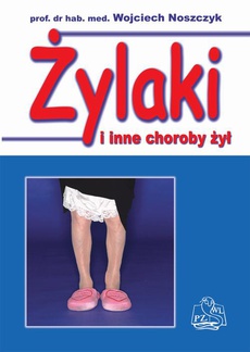 The cover of the book titled: Żylaki i inne choroby żył i kończyn dolnych