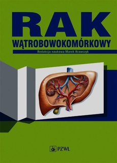 The cover of the book titled: Rak wątrobowokomórkowy