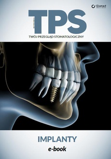 Okładka książki o tytule: Implanty
