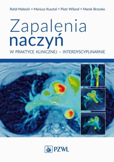 The cover of the book titled: Zapalenia naczyń w praktyce klinicznej interdyscyplinarnie