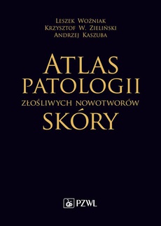 The cover of the book titled: Atlas patologii złośliwych nowotworów skóry