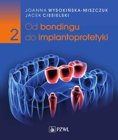 The cover of the book titled: Od bondingu do implantoprotetyki Część 2