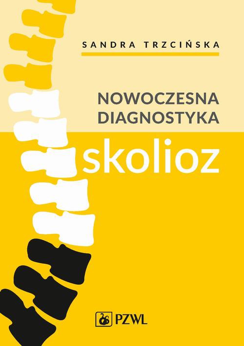 Обкладинка книги з назвою:Nowoczesna diagnostyka skolioz