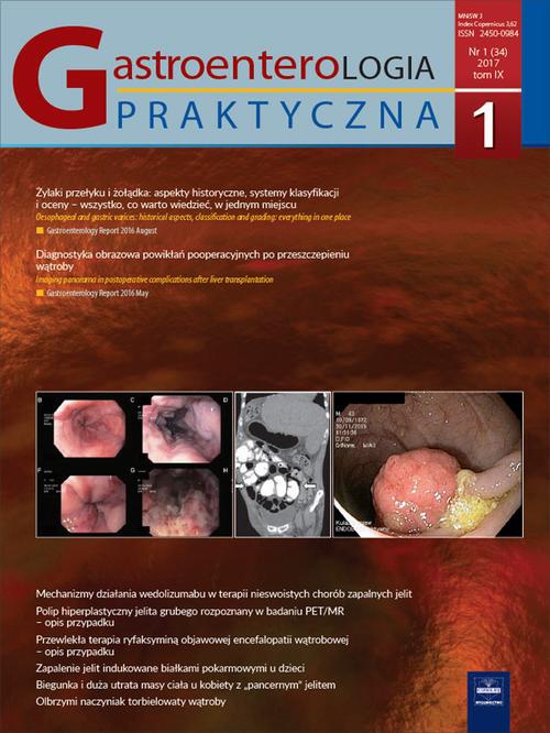 Okładka książki o tytule: Gastroenterologia Praktyczna 1/2017