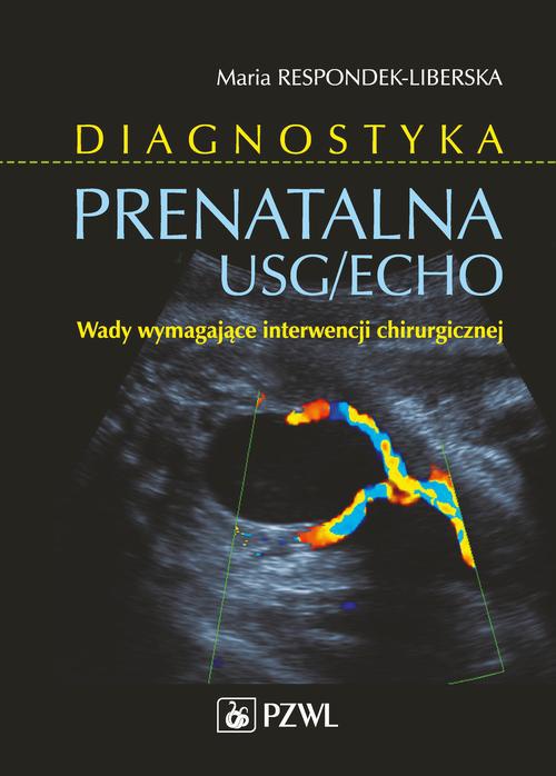 The cover of the book titled: Diagnostyka prenatalna USG/ECHO
