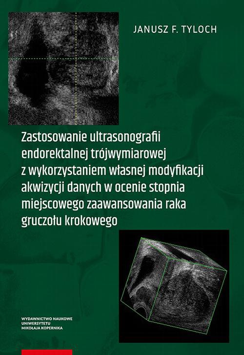 Okładka książki o tytule: Zastosowanie ultrasonografii endorektalnej trójwymiarowej z wykorzystaniem własnej modyfikacji akwizycji danych w ocenie stopnia miejscowego zaawansowania raka gruczołu krokowego