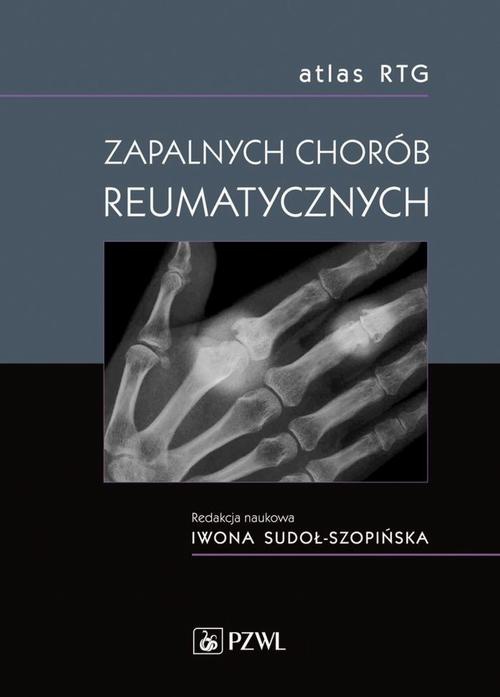 Обложка книги под заглавием:Atlas RTG zapalnych chorób reumatycznych