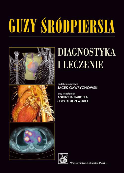 Обложка книги под заглавием:Guzy śródpiersia. Diagnostyka i leczenie