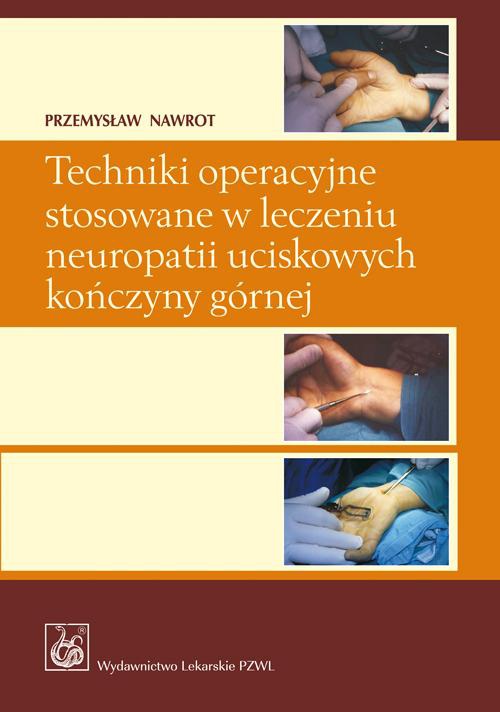 Обкладинка книги з назвою:Techniki operacyjne stosowane w leczeniu neuropatii uciskowych kończyny górnej.