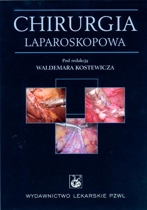 Okładka książki o tytule: Chirurgia laparoskopowa