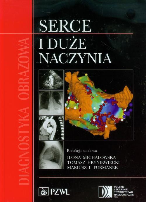 The cover of the book titled: Diagnostyka obrazowa Serce i duże naczynia