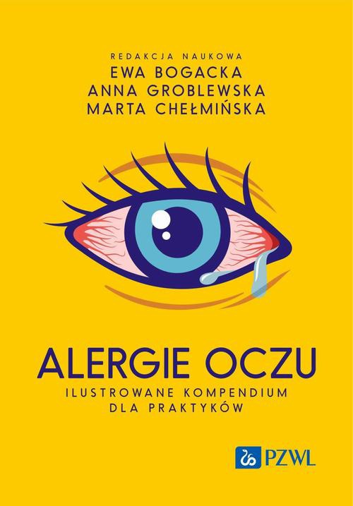 Okładka:Alergie oczu. Ilustrowane kompendium dla praktyków 