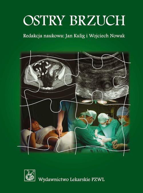 Okładka książki o tytule: Ostry brzuch. Podręcznik dla lekarzy i studentów