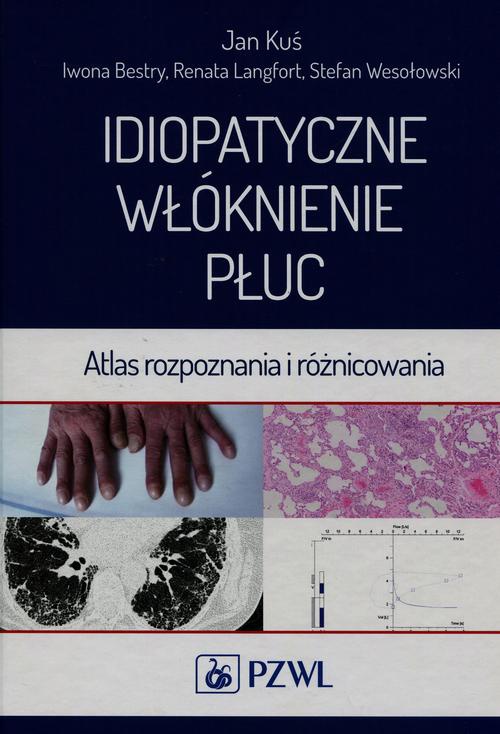 Okładka książki o tytule: Idiopatyczne włóknienie płuc
