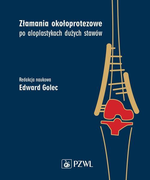 Okładka książki o tytule: Złamania okołoprotezowe po aloplastykach dużych stawów