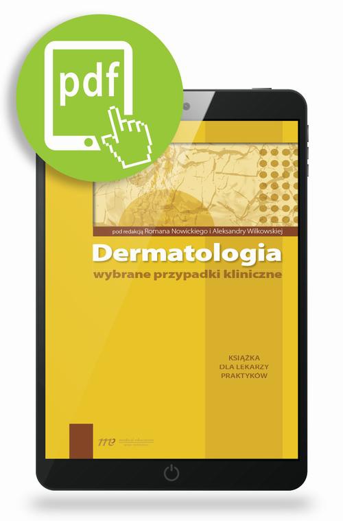 Okładka książki o tytule: Dermatologia - wybrane przypadki kliniczne