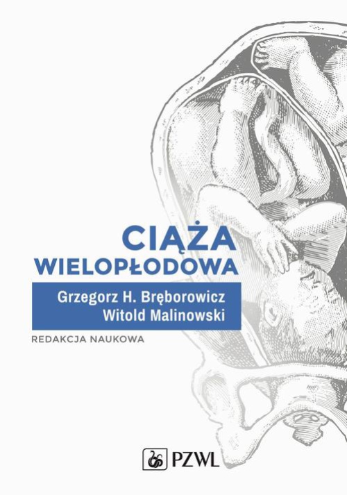 Обкладинка книги з назвою:Ciąża wielopłodowa