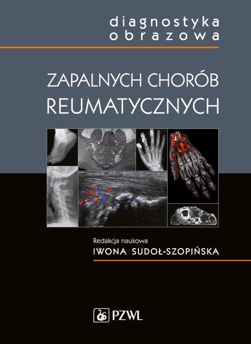 Обложка книги под заглавием:Diagnostyka obrazowa zapalnych chorób reumatycznych