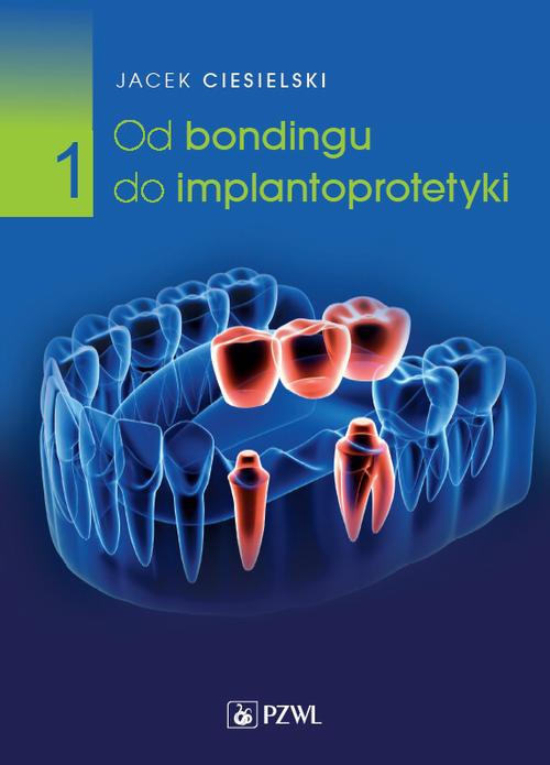 The cover of the book titled: Od bondingu do implantoprotetyki Część 1