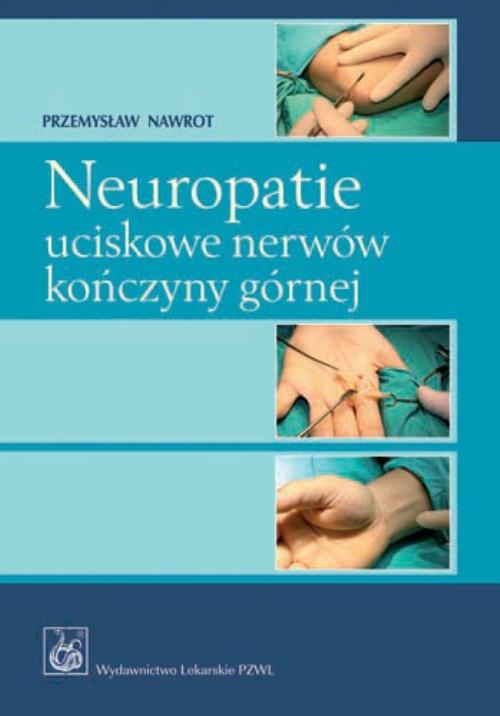 Okładka książki o tytule: Neuropatie uciskowe nerwów kończyny górnej