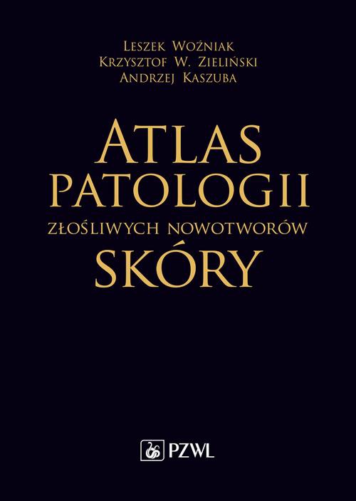 The cover of the book titled: Atlas patologii złośliwych nowotworów skóry