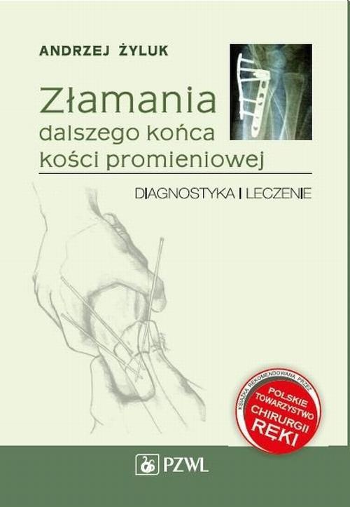 The cover of the book titled: Złamania dalszego końca kości promieniowej